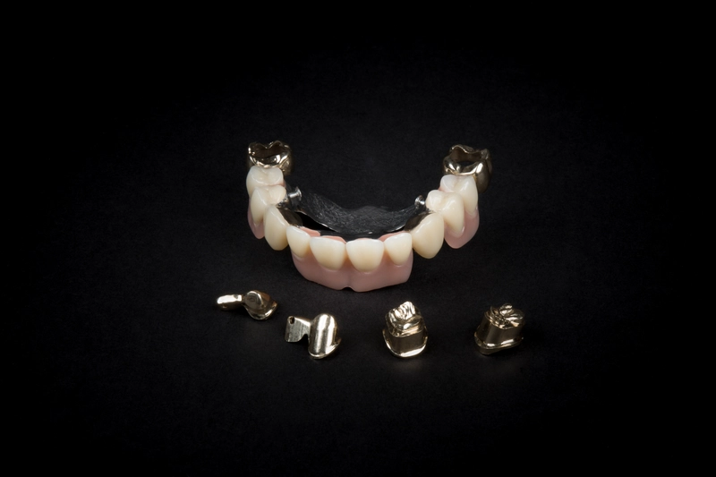 R&V Qualitätszahntechnik - Dentallabor - ein gegossenes Metallgerüst für eine herausnehmbare Teilprothese,